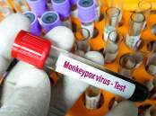 Experts say the current epidemiology of monkeypox cases is unusual and that means that vigilance is required across the world. Picture: Shutterstock.