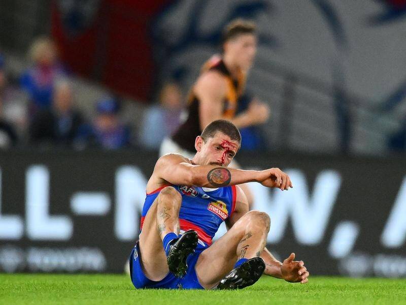 Tom Liberatore is back from concussion for the Bulldogs but his future is yet to be determined. (Morgan Hancock/AAP PHOTOS)